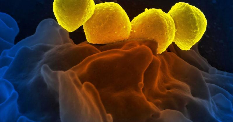 Oamenii de știință au reînviat un ”virus zombi” de acum aproape 50.000 de ani